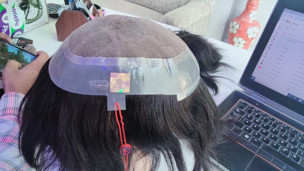 German Hair Patch