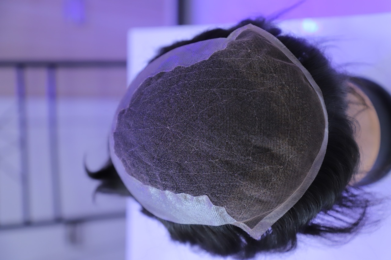 Q6 Hair Patch - Image 3
