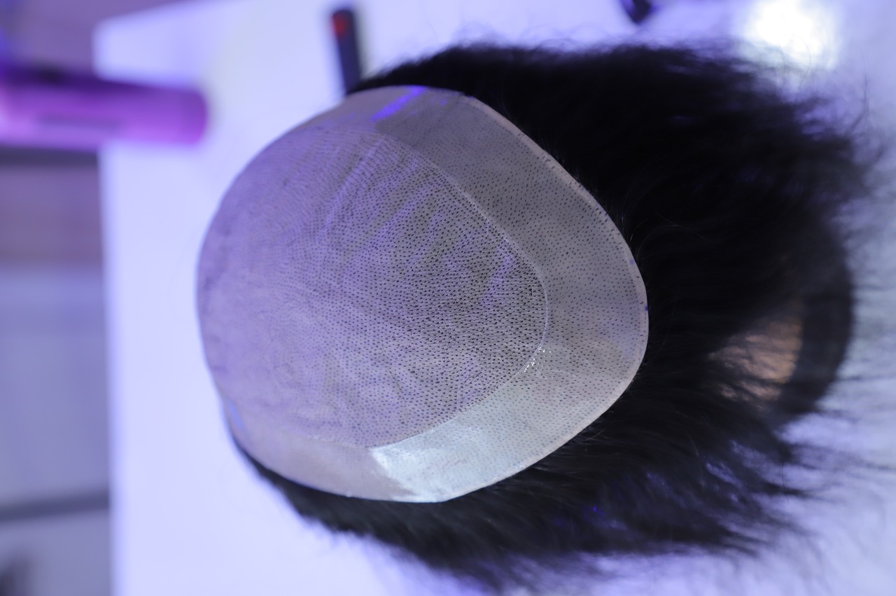 Silkbase Hair Patch - Image 2