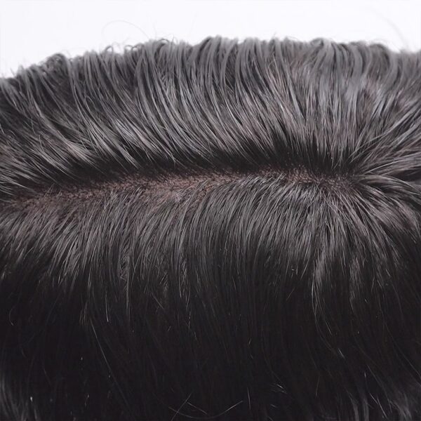 Best Los Angeles Hair Patch In Delhi