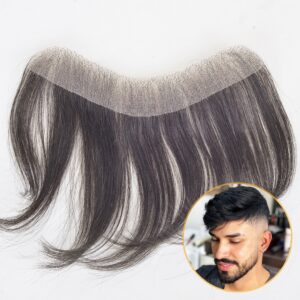 Front-Line Hair Patch In Delhi