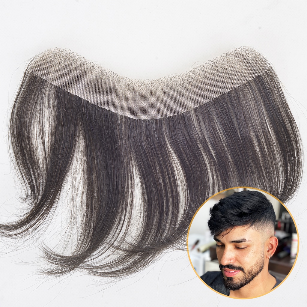 Front-Line Hair Patch In Delhi
